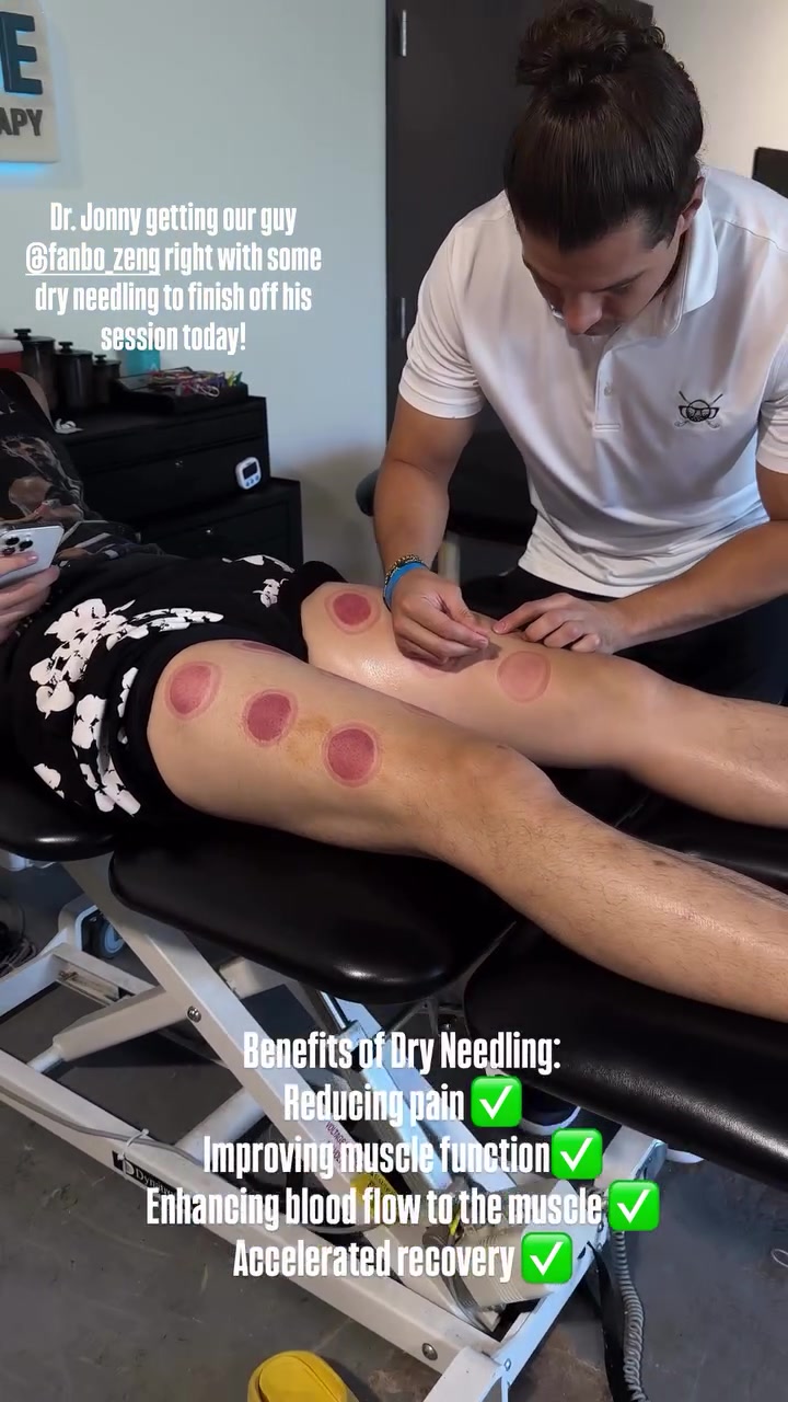 曾凡博腿部接受干针疗法！网媒：曾凡博月底来布鲁克林和篮网会合